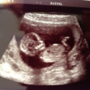 Our Baby at 20 weeks.